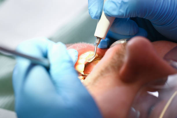 Best Weekend Emergency Dentist in St Charles, IL