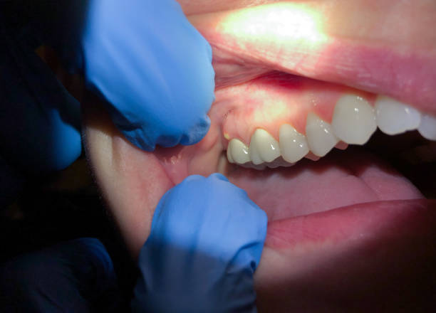 Best Emergency Dentist for Special Needs Patients in St Charles, IL