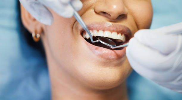 Best Emergency Dental Services for Seniors in St Charles, IL